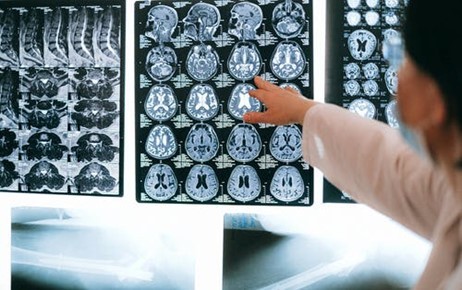Doctor studying brain scans